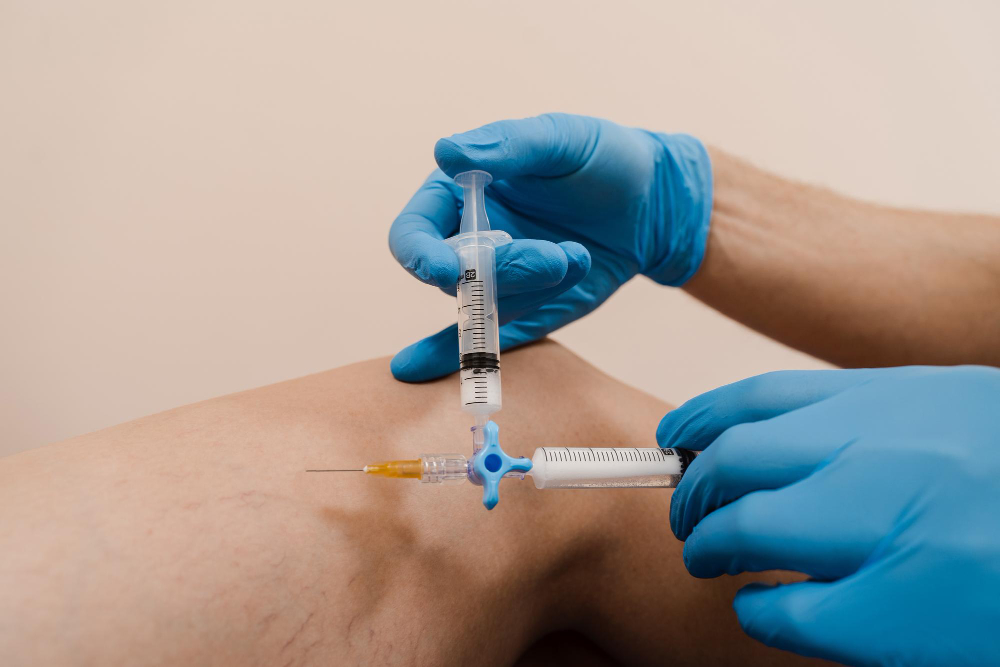 Sclerotherapy in Huntington Beach, CA